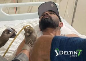 Muhammad Shami ODI Series Injury